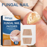 Fungal Nail Treatment Patch Anti Infection Paronychia Thickening Soft Onychomycosis Repair Ingrown Toenails Correction Stickers