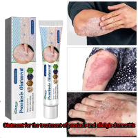 Special cream, psoriasis cream – imported – for scalp itching, dandruff, body itching, itching, skin