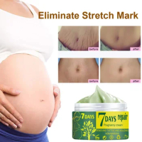 Pregnancy Repair Cream Stretch Mark Removal Removal Acne Scar Stretch Marks Cream Fat Striae Gravidarum Treatment Body Creams