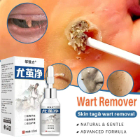 Obat Kutil HPV Alami - Menghilangkan Kutil di Wajah Tangan Leher 15ML (Pengiriman Rahasia)
