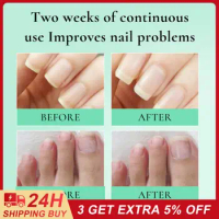 Cuticle Oil Hydrating Nail Care Restoring Promotes Healthy Nail Growth Nail Growth Healthy Nails Nail Nutrition Oil Nourishing