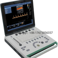 Notebook-Style Veterinary Color Ultrasound Vet Ultrasound hine Equipment
