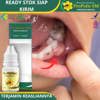 Propolis SM - Untuk Abses Gigi / Abses Gusi, Benjolan Di Gusi, Pengempis Abses Gigi / Gusi Bengkak