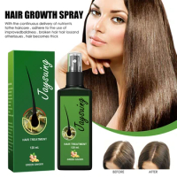 120ml Hair Growth Products Hair Growth Spray Hair Care Nutrient Solution Anti-Hair Loss Improves Hair Quality Grow Hair