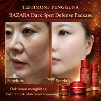 PAKET FLEK MELASMA DARK SPOT DEFENSE SET RAZARA SKINCARE Perawatan Wajah FLEK