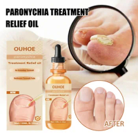 Nail Essence 10ml Restores Appearance of Discolored or Damaged Nails Nail Renew Care Вейпы И Поды Voopoo Бар Feet Care
