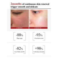 Salicylic Acid Pore Shrinking Cream Quick Elimination Large Pores Remove Blackehead Tighten Face Smooth Skin Care Korean Product