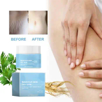 Stretch Mark Cream Remover 100g Scar And Stretch Mark Remover Cream Belly Cream Massage Lotion For All Skin Types Reduces Scar