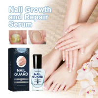 15ml Hand Foot Nail fungal Treatment Solution To Remove Liquid Liquid Care Care Nail Onychomycosis Repair Healthy Repair W8Q6