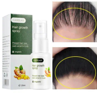 Ginger Hair Growth Serum Spray Fast Hair Growth Liquid Treatment Scalp Hair Follicle Anti Hair Loss Repair Hair Care Products