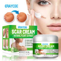 ERAYCEE Natural Aloe Vera Scar Fading Cream for Acne Marks, Burns, and Surgeries