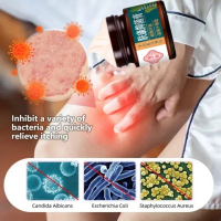 FUKANG Kem nấm ngứa, viêm da dị ứng, vẩy nến.Chiết xuất từ thảo mộc tự nhiên chính hãng 30g