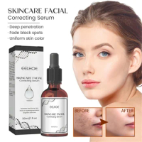 Retinol Dark Spot Remover Face Serum Whitening Skin Care Freckle Removal Pigment Lighten Collagen Hyaluronic Acid Facial Serum