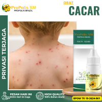 Propolis sm Tetes Cacar Air, Cacar Api, Cacar Air Anak, Cacar Dewasa, Penghilang Bekas Cacar Air Ber