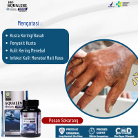 Mengatasi Penyakit Kusta Kering Basah, Kusta Kulit Menebal, Kulit Kering Perih, Kulit Tangan Mati Ra