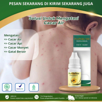 Propolis SM - Solusi Untuk cacar Air & Bekas Cacar, Pengering Luka Cacar, Cacar api / Cacar Ayam, Ca