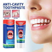 30G Teeth Whitening Anti-cavity Toothpaste Removal Tooth Stains Fresh Breath Tooth Care New