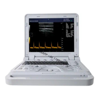 CONTEC CE CMS600P2PLUS Digital Notebook Cheap Portable Ultrasound Machine Price