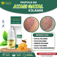 Propolis SM Salep Oles Atasi Gatal Ruam di Kelamin, Infeksi Jamur Kulit, Bentol di Buah Jakar, Kutu