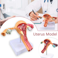 Model Patologis Uterus Ovarium Alat Peraga Reproduksi Wanita  Anatomy Alat Peraga Anatomi Peraga Ana