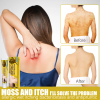 Krim Perbaikan Psoriasis Meredakan Gatal pada Eksim Kaki akibat Dermatitis Atopik 20g