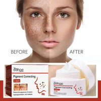 Eelhoe Pigment Repair Cream Moisture Replenishment Fade Freckles Black Spots Melasma Melanin Skin Whitening Skin Rejuvenation