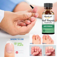 20m Lnail Fungal Treatment Feet Care Essence Nails Fungus Toe Infection Repair Removal Oils Anti Nail Foot Paronychia Y0p9