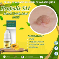 Propolis SM - Mengatasi Kutil Tangan, Tetes Kutil, Penghilang Kutil, Kutil di Kelopak Mata, Cairan