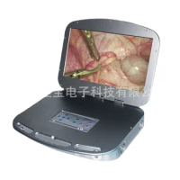 HD portable notebook endoscope camera hysteroscope laparoscopic arthroscopy intervertebral foramen camera