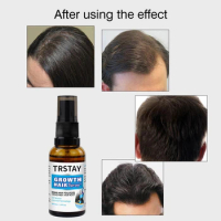 Hair Growth Fluid Nourishing Thick Growth Hair Oil Spray Growth Hair Spray Hair Treatment Products Care