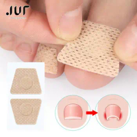 Nail Repair Patch Grey Fungal Nails Thickening Soft Paronychia Treatment Anti Infection Correction Sticker Ingrown Toenail Care