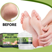 Urea cream hand foot care anti-dry Cracked exfoliation Removal Dead Skin Softening moisturizing hydrating hands feet repair mask