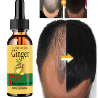 Growth Tool Hairloss Hair Alopecia Hair Treatment for Women HAIR CARE GROWTH GINGER TONIC OIL Beard Growth