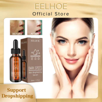 Whitening Serum Remove Freckle Pigment Acne Mark Melanin Correcting Fade Melasma Chloasma Sunburn Brighten Anti Dark Spot Serum