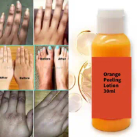 Peeling Cream Dark Knuckles Knees Toes Large Areas on The Body Orange Body Lotion Extra Strength