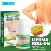 Roller Lipoma Lipoma Cream 20g Lipoma Removal Cream Benjolan Di Leher Tangan Ketiak Salep Lipoma Pen