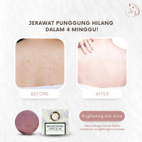 Sabun Bunga Safron untuk Membersihkan jerawat badan dan wajah