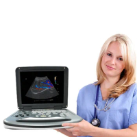 Notebook portable 2d Color Doppler abdominal ultrasound machine HE-E60 with 15 inches LCD