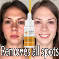 Vitamin C Freckle Whitening Serum Remove Dark Spot Fade Pigment Melanin Correcting Facial Essence Moisturize Brighten Skin Care