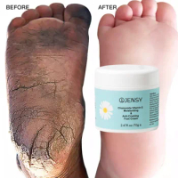 70g Foot Care Cream Cracked Heels Exfoliating Anti Crack Peeling Dead Skin Removal Foot Repair Whitening Urea Foot Cream