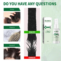 Sdotter New 35ml Hair Growth Spray Repair Hairs Follicle Damage Dry And Frizzy Hairs Thick Anti-fall Hair Spray