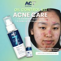 AC7D Oil Control Kit (Serum 10ml + ClearSkin Wash 100ml) - Acne Clear 7 Days | Acne Treatment for Ac