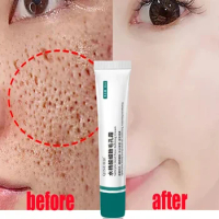 Salicylic Acid Pore Quick Shrinking Cream Large Pores Tightening Moisturizing Smooth Oil Control Skin Care Korean Cosmetic