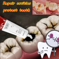 100g Probiotic Caries Toothpaste SP4 Whitening Repair Tooth Decay Paste Cleaner Teeth Remover Plaque Fresh Breath Oral Care