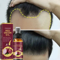 Powerful Hair Growth Serum Spray Repair Nourish Root Regrowth Anti Hair Loss Treatment Essence For Men Women Hair Care 30ml