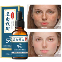 Effective Freckle Whitening Serum Curcumin Oil Brighten Fade Dark Spot Removal Pigment Melanin Correcting Beauty Face Skin Care