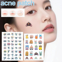 Pelekat Jerawat Kartun Stitch, Pelekat Jerawat Warna PE dengan Beg, Pelekat Jerawat, Penjagaan Wajah