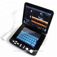 Veterinary Equipment: PRUS-R3000V 12.1inch Laptop Veterinary Ultrasound Equipment