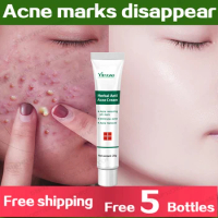 Salicylic Acid Acne Cream Face Care Ointment Remove Acne Eliminate Acne Mark Pore Contraction Oil Control Anti-Inflammatory 20g