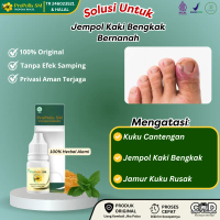 Tetes Untuk Kuku Cantengan Kuku Rusak Kuku Kaki Bengkak Dan Bau Jempol Kaki Bengkak Berdarah, Sakit 